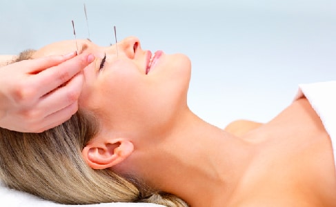 Anti-aging acupunctuur
