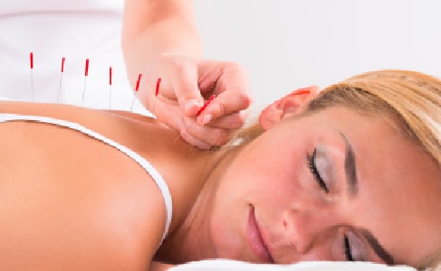 Cursus Dry needling