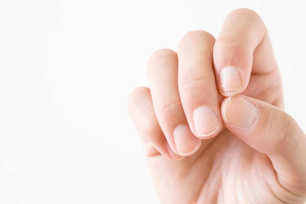 Hoe kan ik broze nagels het beste verzorgen?