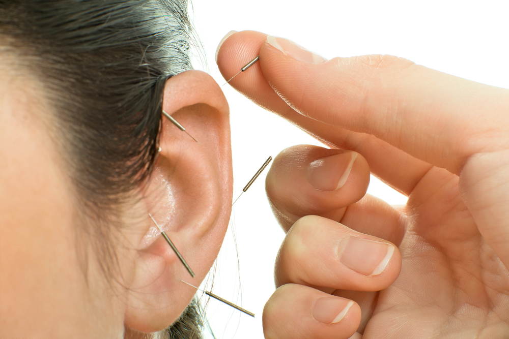 5 goede redenen voor een ooracupunctuur cursus!