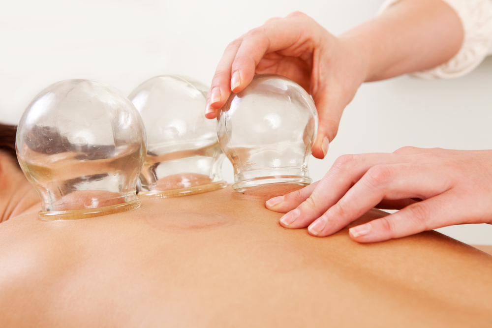 Waarom is cupping massage populair?