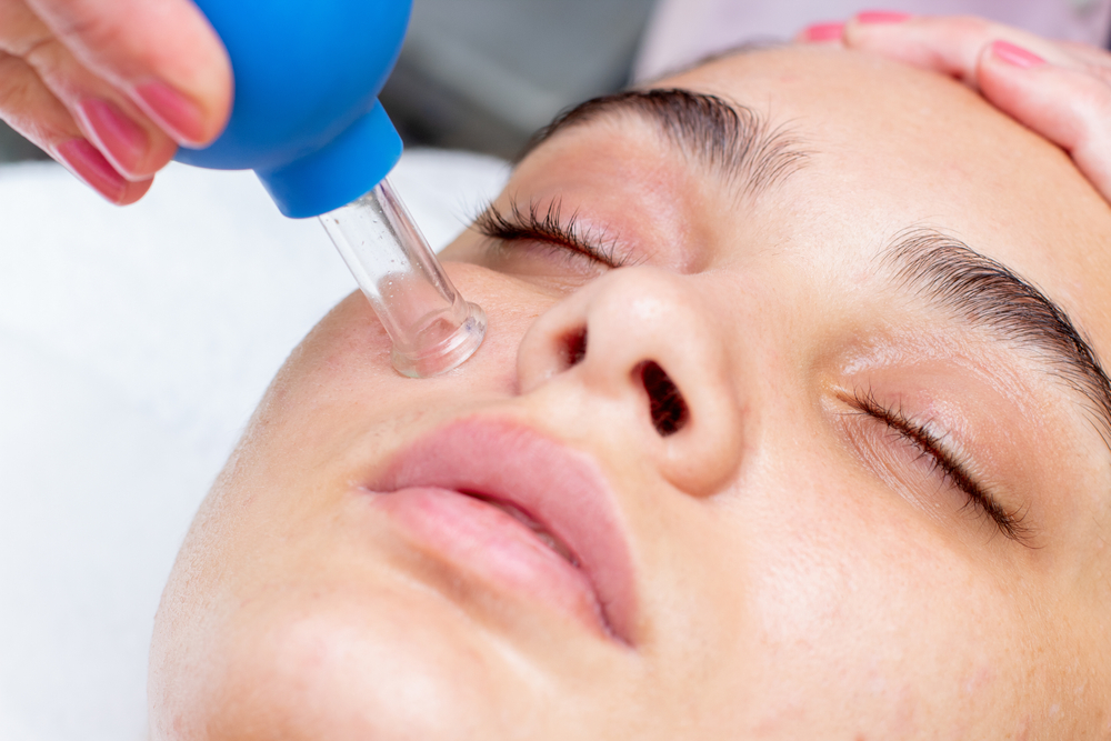 Cursus facial cupping voor natuurlijke schoonheid!