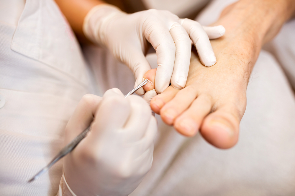 Pedicure, voetverzorger of podoloog: het verschil